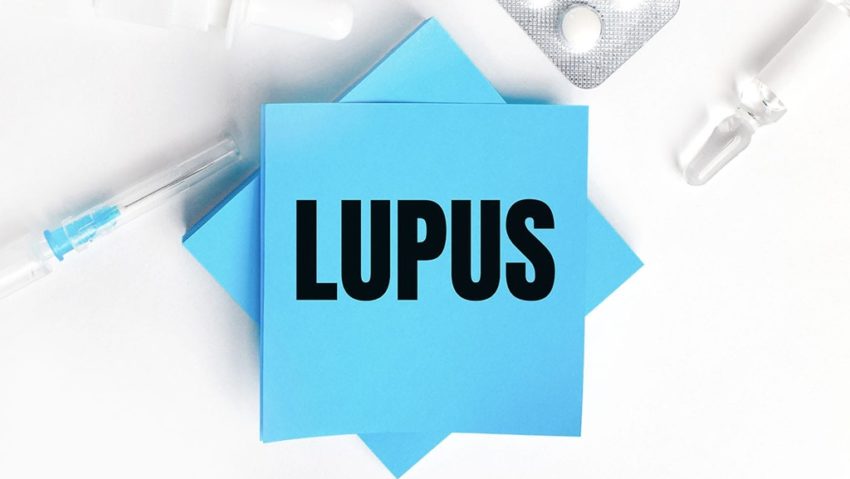 S-a descoperit o cauză genetică a lupusului S-a descoperit o cauză genetică a lupusului