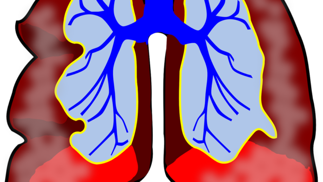 Teste gratuite pentru depistarea afecțiunilor pulmonare
