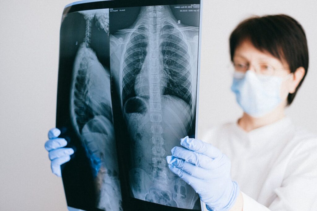 Pneumopatiile, în creștere: 127 de pacienți la spital într-o săptămână