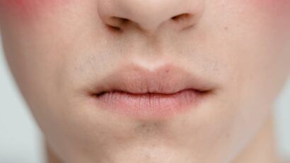 Gravitatea infecţiilor depinde de mucoasa nazală