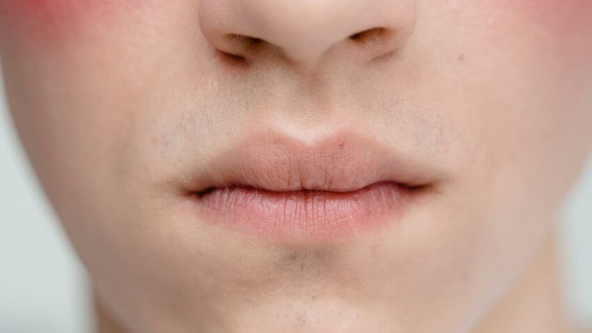 Gravitatea infecţiilor depinde de mucoasa nazală