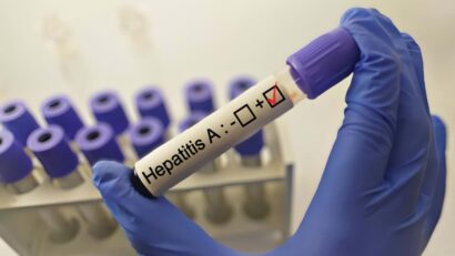 Focar de hepatită A