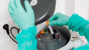 Plasmafereza, procedura medicală revenită în atenție după moartea cântărețului grec Giorgos Mazonakis