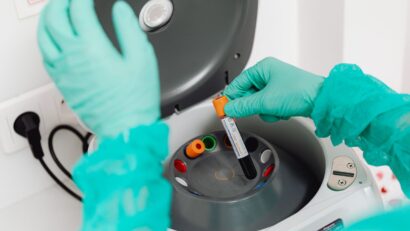 Plasmafereza, procedura medicală revenită în atenție după moartea cântărețului grec Giorgos Mazonakis
