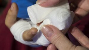 Cum îngrijim corect o rană: greșeli frecvente