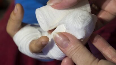 Cum îngrijim corect o rană: greșeli frecvente