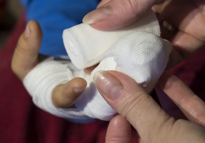 Cum îngrijim corect o rană: greșeli frecvente